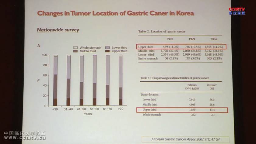 JY Park：早期胃癌腹腔镜近端胃切除术与腹腔镜全胃切除术疗效评估